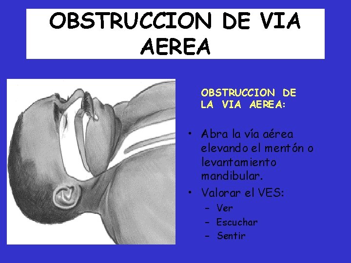 OBSTRUCCION DE VIA AEREA OBSTRUCCION DE LA VIA AEREA: • Abra la vía aérea