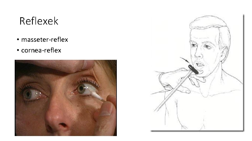 Reflexek • masseter-reflex • cornea-reflex Reflexek • masseter-reflex • cornea-reflex