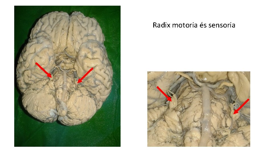 Radix motoria és sensoria Radix motoria és sensoria