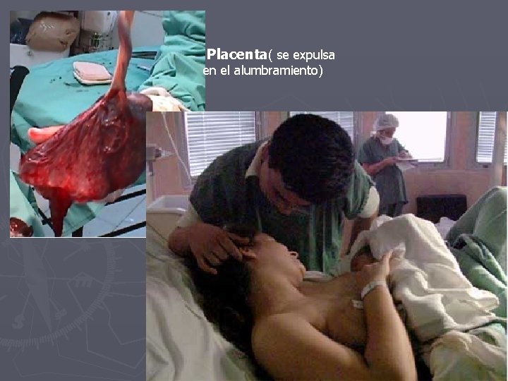 Placenta( se expulsa en el alumbramiento) 