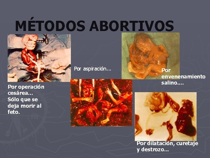 MÉTODOS ABORTIVOS Por aspiración. . . Por operación cesárea. . . Sólo que se