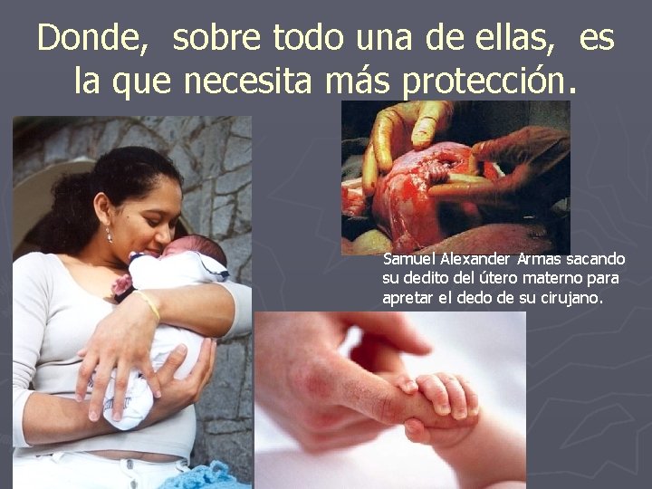 Donde, sobre todo una de ellas, es la que necesita más protección. Samuel Alexander