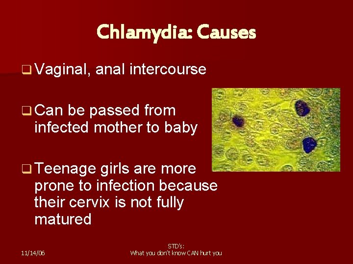 Chlamydia: Causes q Vaginal, anal intercourse q Can be passed from infected mother to
