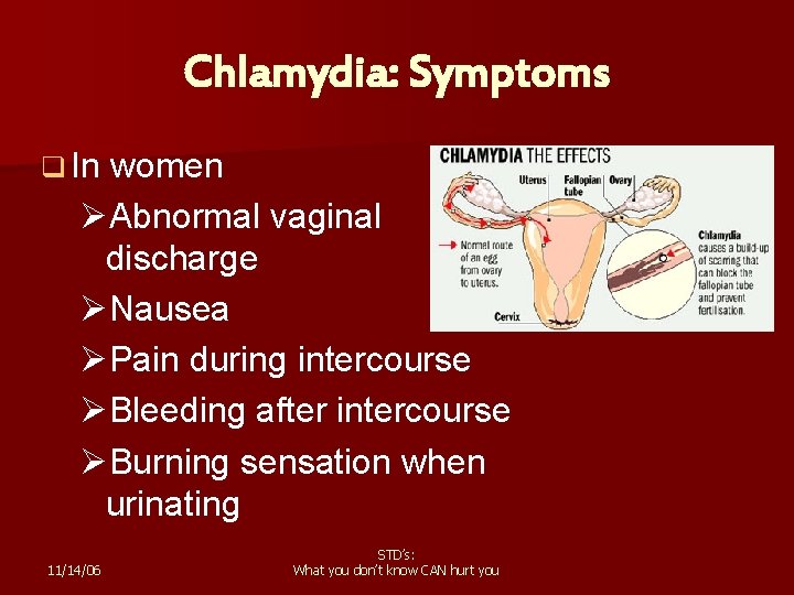 Chlamydia: Symptoms q In women ØAbnormal vaginal discharge ØNausea ØPain during intercourse ØBleeding after