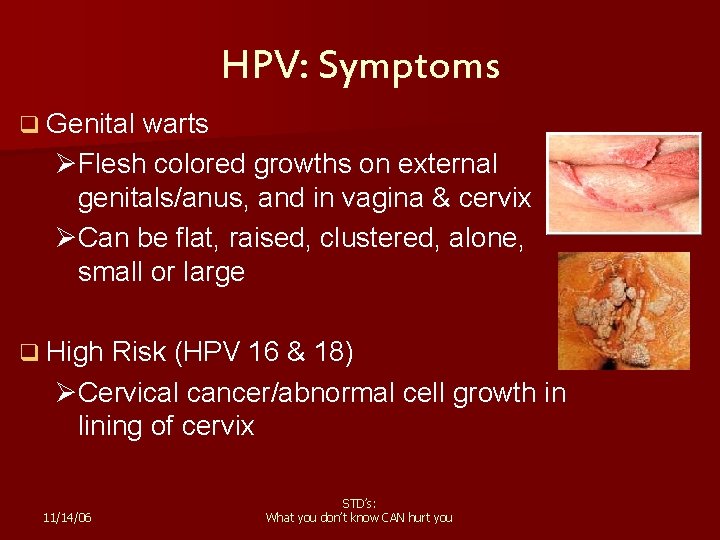 HPV: Symptoms q Genital warts ØFlesh colored growths on external genitals/anus, and in vagina