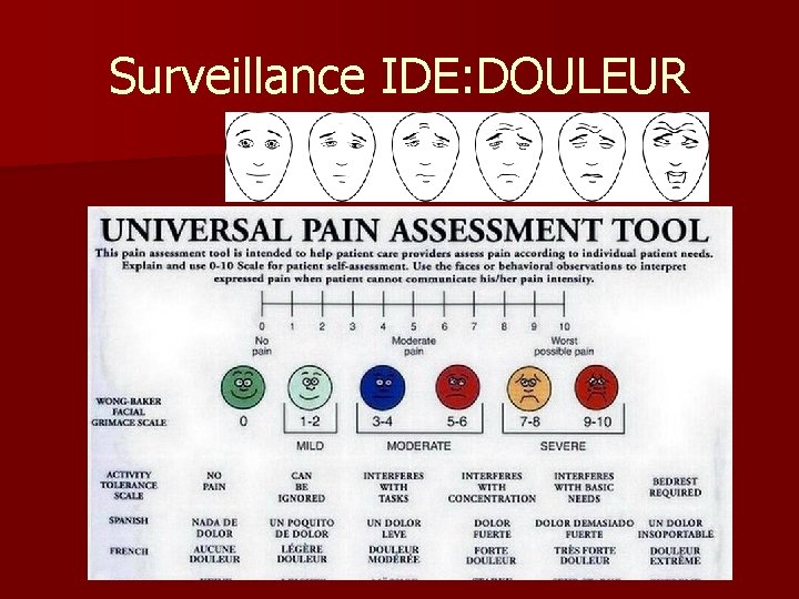 Surveillance IDE: DOULEUR 