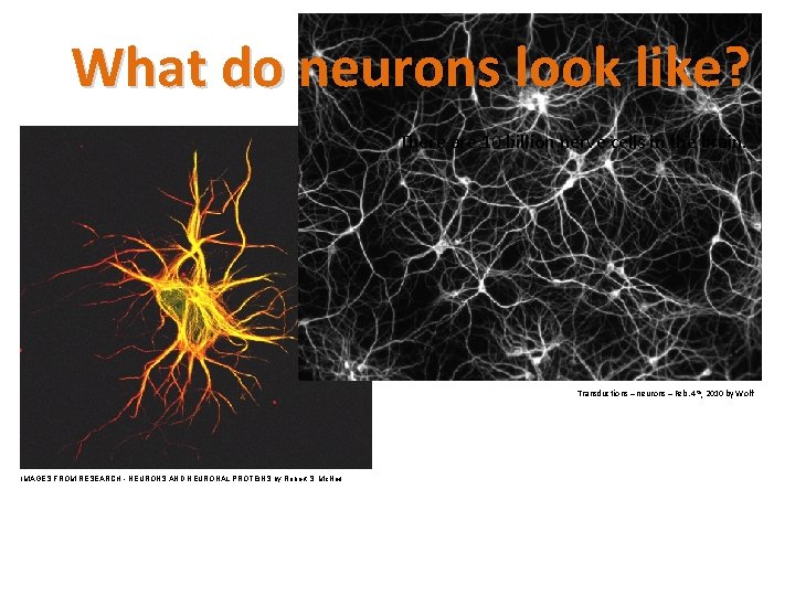 What do neurons look like? There are 10 billion nerve cells in the brain.