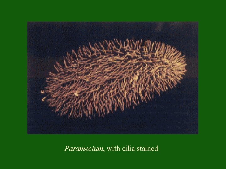 Paramecium, with cilia stained 