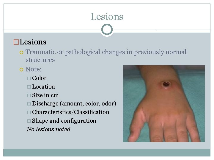 Lesions �Lesions Traumatic or pathological changes in previously normal structures Note: � Color �