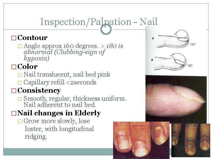 Inspection/Palpation - Nail � Contour � Angle approx 160 degrees. > 180 is abnormal