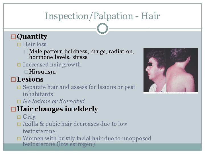 Inspection/Palpation - Hair � Quantity � Hair loss � Male pattern baldness, drugs, radiation,