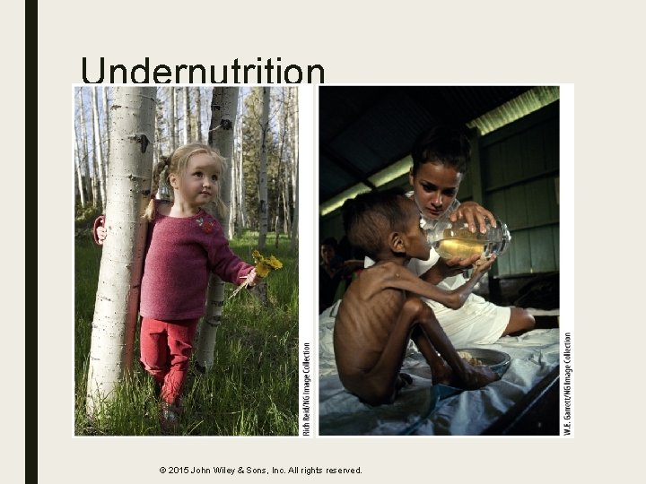 Undernutrition © 2015 John Wiley & Sons, Inc. All rights reserved. 
