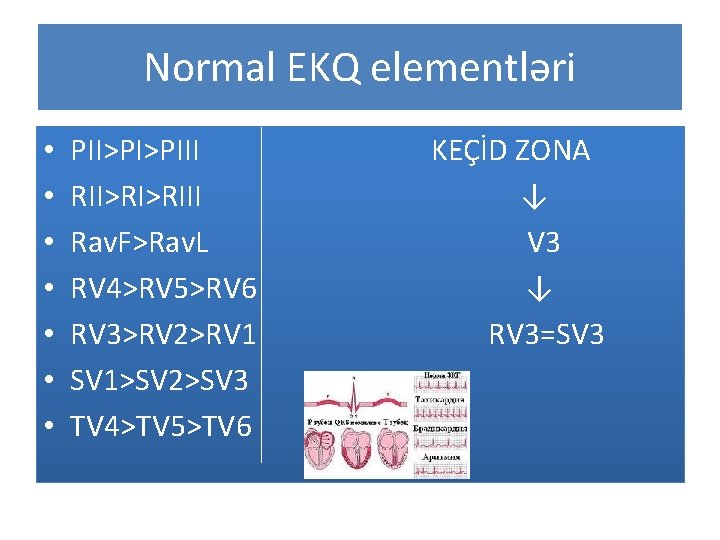 Normal EKQ elementləri • • PII>PI>PIII RII>RI>RIII Rav. F>Rav. L RV 4>RV 5>RV 6