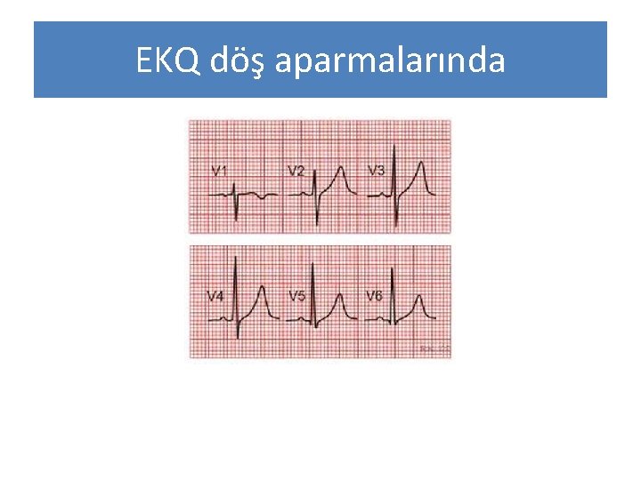 EKQ döş aparmalarında 