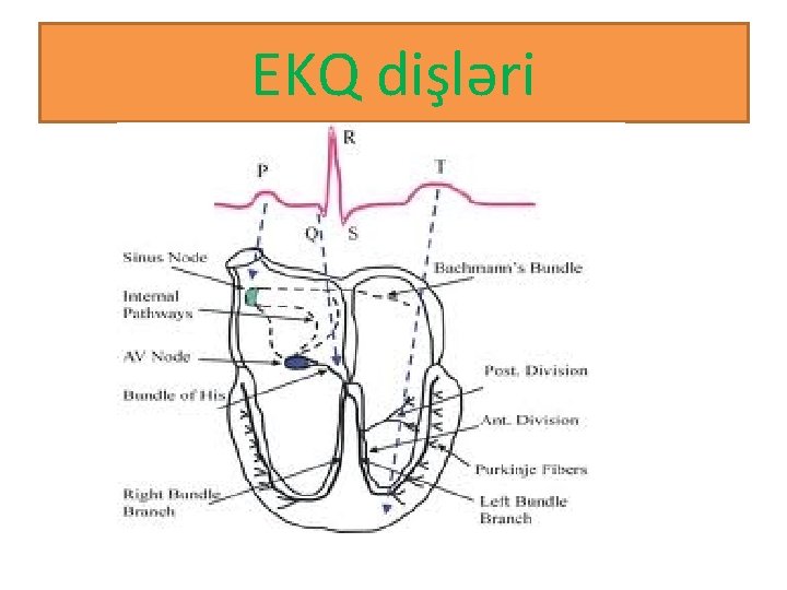 EKQ dişləri 