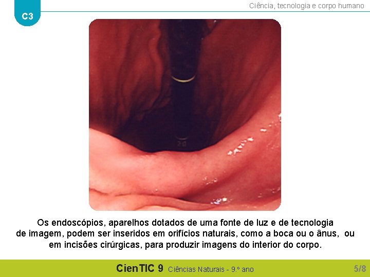 Ciência, tecnologia e corpo humano C 3 Os endoscópios, aparelhos dotados de uma fonte