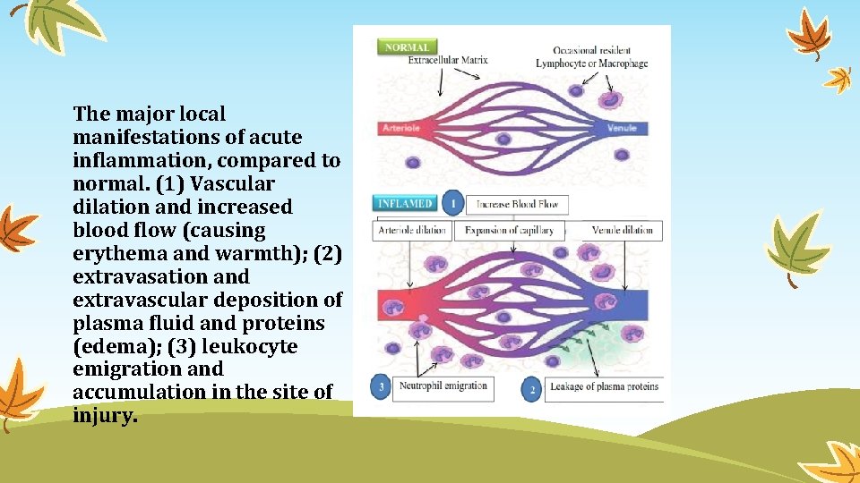 The major local manifestations of acute inflammation, compared to normal. (1) Vascular dilation and