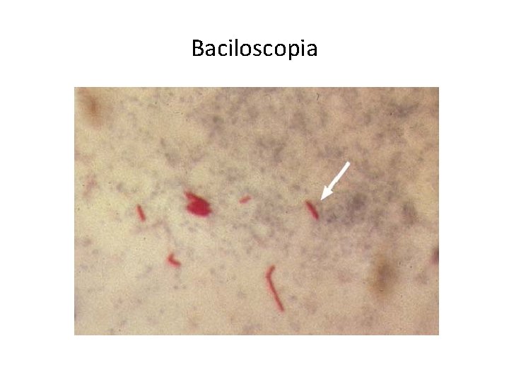 Baciloscopia 