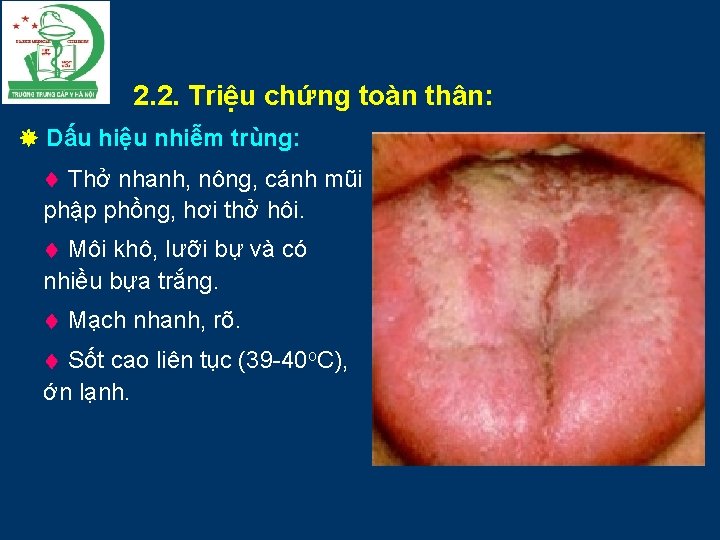 2. 2. Triệu chứng toàn thân: Dấu hiệu nhiễm trùng: Thở nhanh, nông, cánh