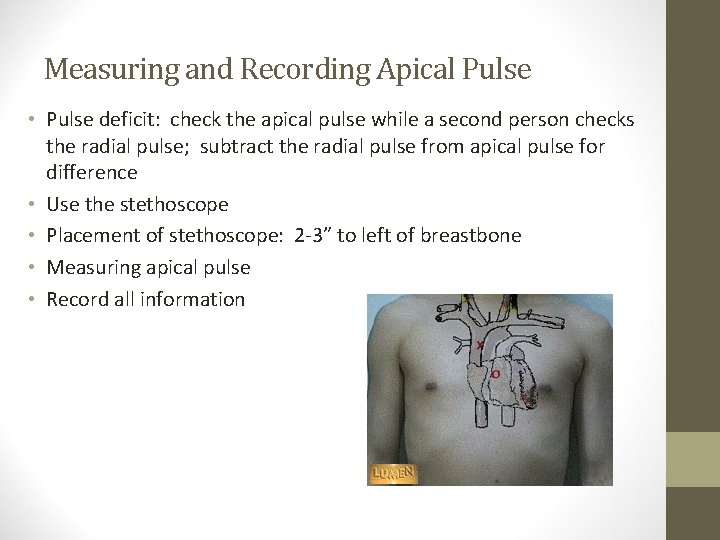 Measuring and Recording Apical Pulse • Pulse deficit: check the apical pulse while a