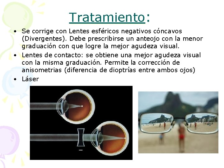 Tratamiento: • Se corrige con Lentes esféricos negativos cóncavos (Divergentes). Debe prescribirse un anteojo