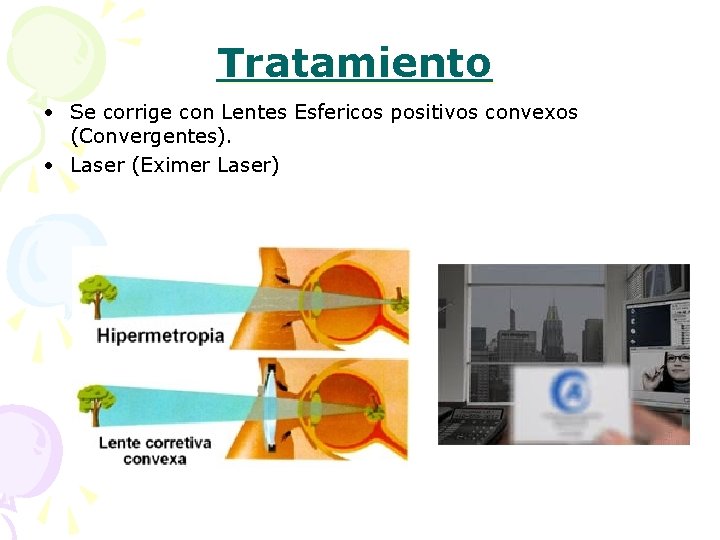 Tratamiento • Se corrige con Lentes Esfericos positivos convexos (Convergentes). • Laser (Eximer Laser)