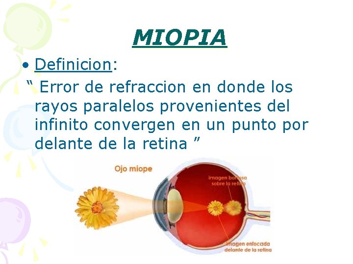 MIOPIA • Definicion: “ Error de refraccion en donde los rayos paralelos provenientes del