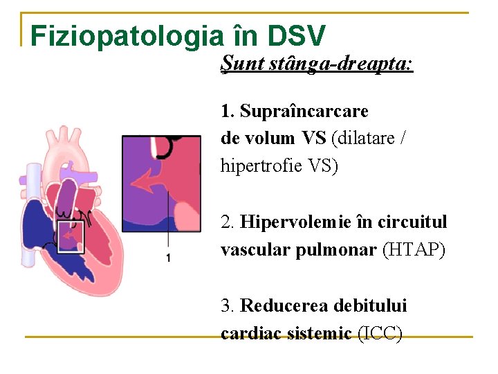 Fiziopatologia în DSV Şunt stânga-dreapta: 1. Supraîncarcare de volum VS (dilatare / hipertrofie VS) Fiziopatologia în DSV Şunt stânga-dreapta: 1. Supraîncarcare de volum VS (dilatare / hipertrofie VS)
