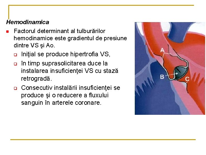 Hemodinamica n Factorul determinant al tulburărilor hemodinamice este gradientul de presiune dintre VS şi Hemodinamica n Factorul determinant al tulburărilor hemodinamice este gradientul de presiune dintre VS şi