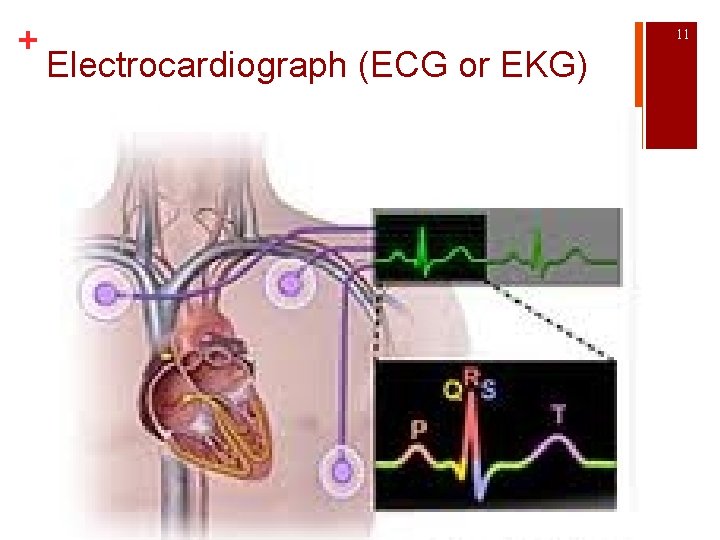 + 11 Electrocardiograph (ECG or EKG) 