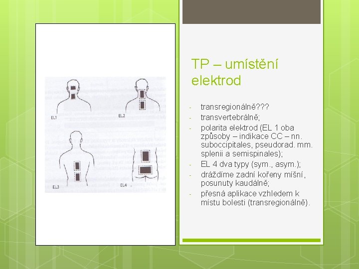 TP – umístění elektrod - - transregionálně? ? ? transvertebrálně; polarita elektrod (EL 1