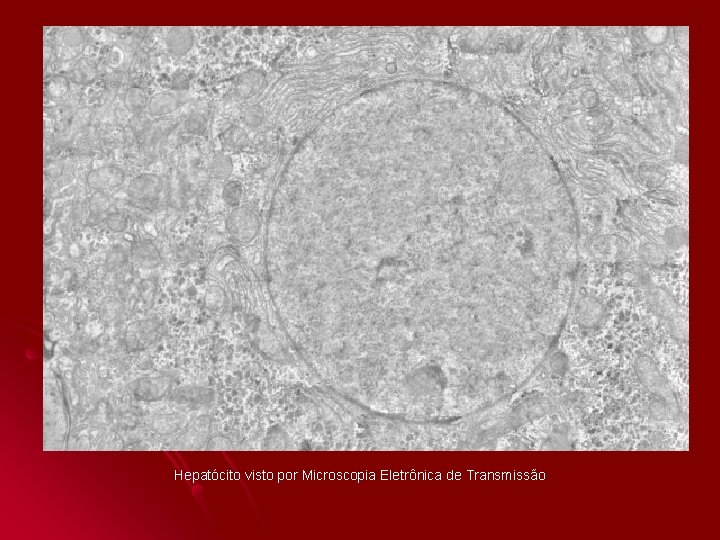 Hepatócito visto por Microscopia Eletrônica de Transmissão Hepatócito visto por Microscopia Eletrônica de Transmissão
