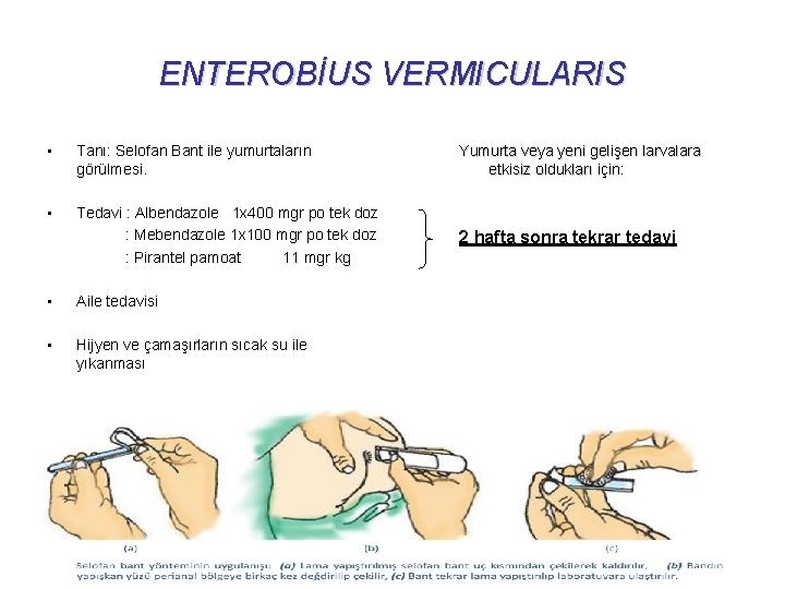 ENTEROBİUS VERMICULARIS • Tanı: Selofan Bant ile yumurtaların görülmesi. Yumurta veya yeni gelişen larvalara