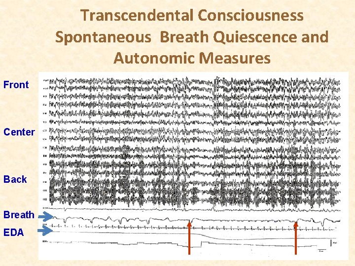 Transcendental Consciousness Spontaneous Breath Quiescence and Autonomic Measures Front Center Back Breath EDA 