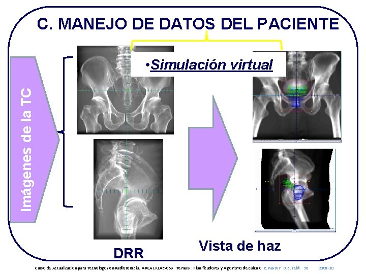C. MANEJO DE DATOS DEL PACIENTE Imágenes de la TC • Simulación virtual DRR