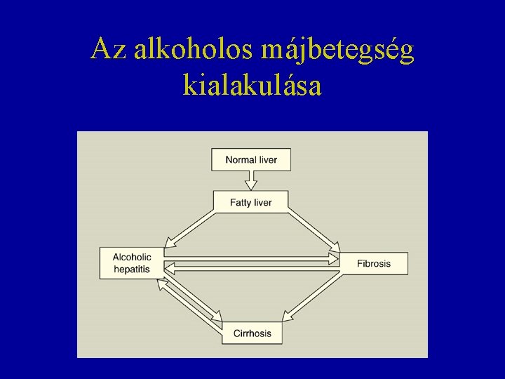 Az alkoholos májbetegség kialakulása 