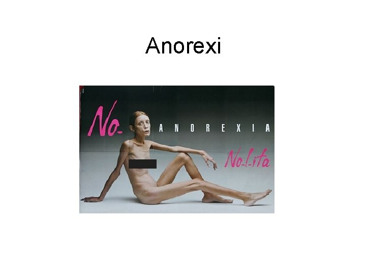 Anorexi 