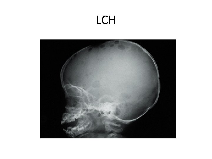 LCH 