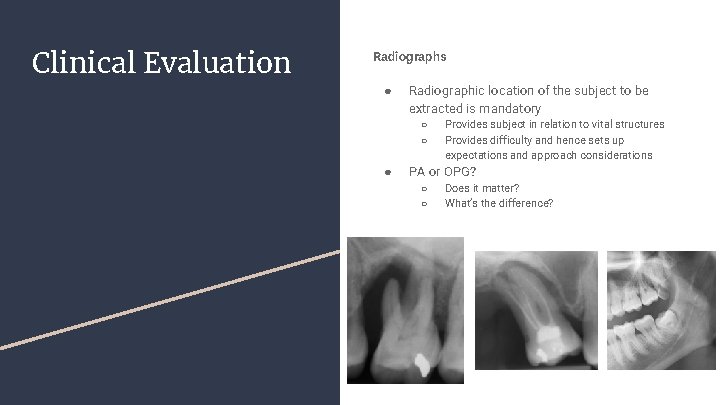 Clinical Evaluation Radiographs ● Radiographic location of the subject to be extracted is mandatory Clinical Evaluation Radiographs ● Radiographic location of the subject to be extracted is mandatory