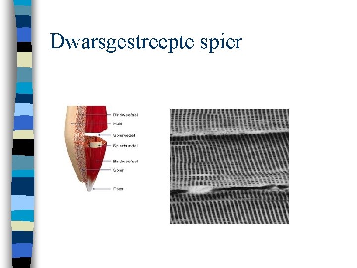 Dwarsgestreepte spier 