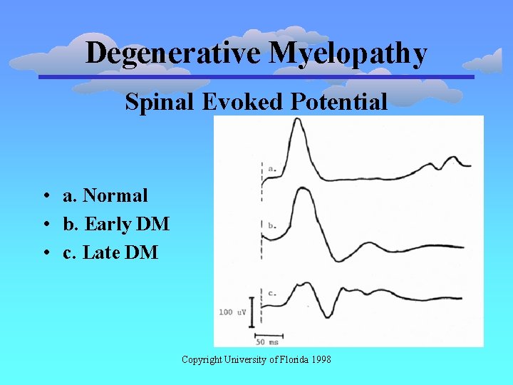 Degenerative Myelopathy Spinal Evoked Potential • a. Normal • b. Early DM • c.