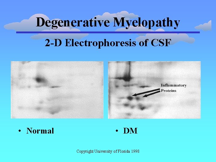 Degenerative Myelopathy 2 -D Electrophoresis of CSF • Normal • DM Copyright University of