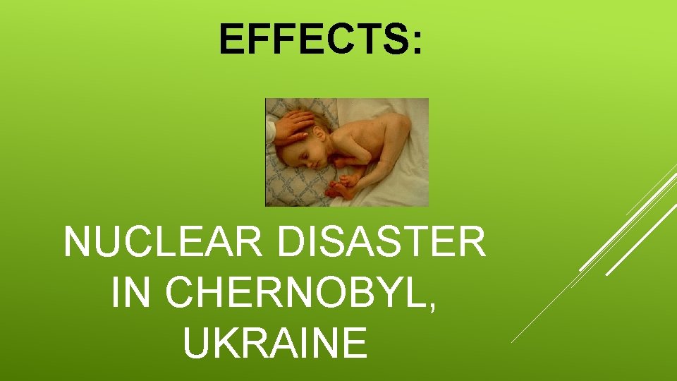 EFFECTS: NUCLEAR DISASTER IN CHERNOBYL, UKRAINE 