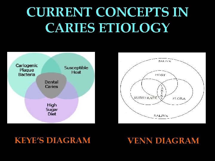 CURRENT CONCEPTS IN CARIES ETIOLOGY KEYE’S DIAGRAM VENN DIAGRAM 