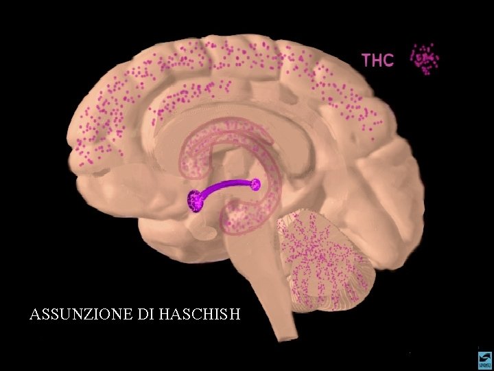 ASSUNZIONE DI HASCHISH 