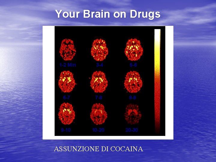 Your Brain on Drugs 1 -2 Min 3 -4 5 -6 6 -7 7