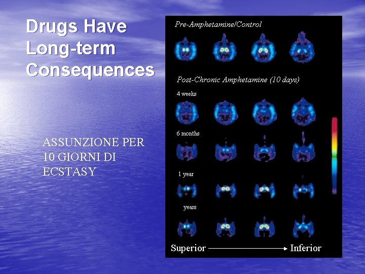 Drugs Have Long-term Consequences ASSUNZIONE PER 10 GIORNI DI ECSTASY 