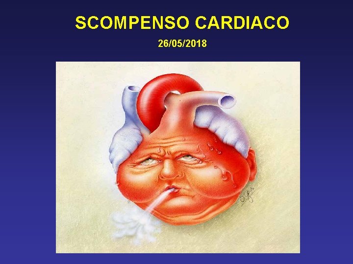 SCOMPENSO CARDIACO 26/05/2018 