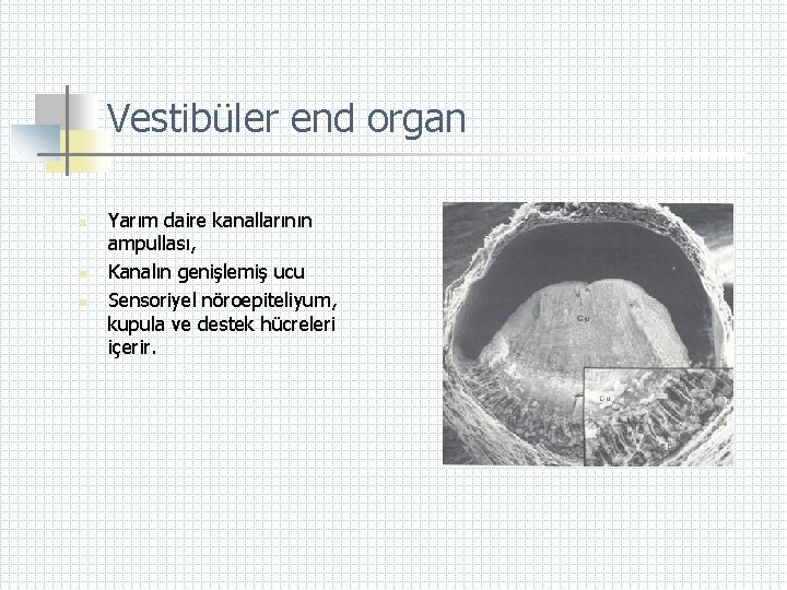 Vestibüler end organ n Yarım daire kanallarının ampullası, Kanalın genişlemiş ucu Sensoriyel nöroepiteliyum, kupula
