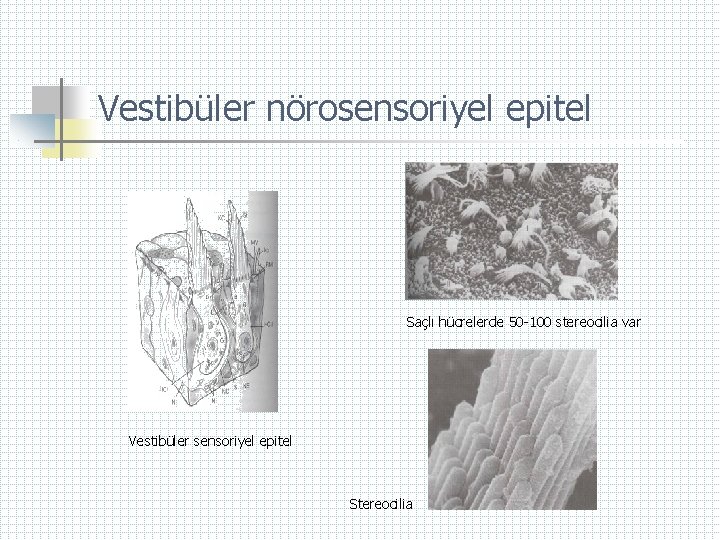Vestibüler nörosensoriyel epitel Saçlı hücrelerde 50 -100 stereocilia var Vestibüler sensoriyel epitel Stereocilia 